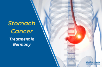 stomach cancer 