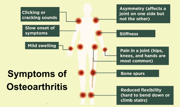 symptoms of osteoarthritis