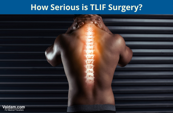 How Serious is TLIF Surgery?