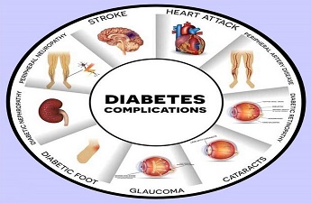 Diabetes – Complications and Management by Dr. Rajendiran N, Senior Consultant, MBBS, MD