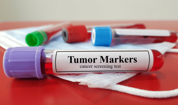 اختبار الدم لعلامات الورم