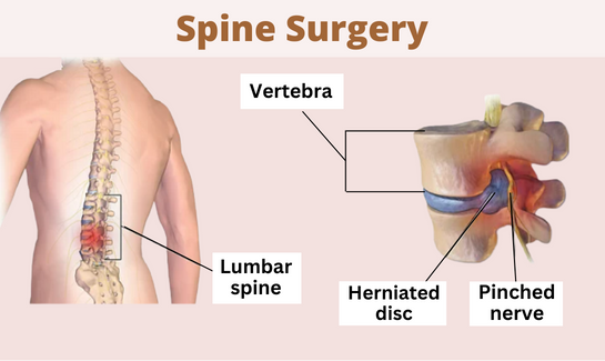 types of spine problems