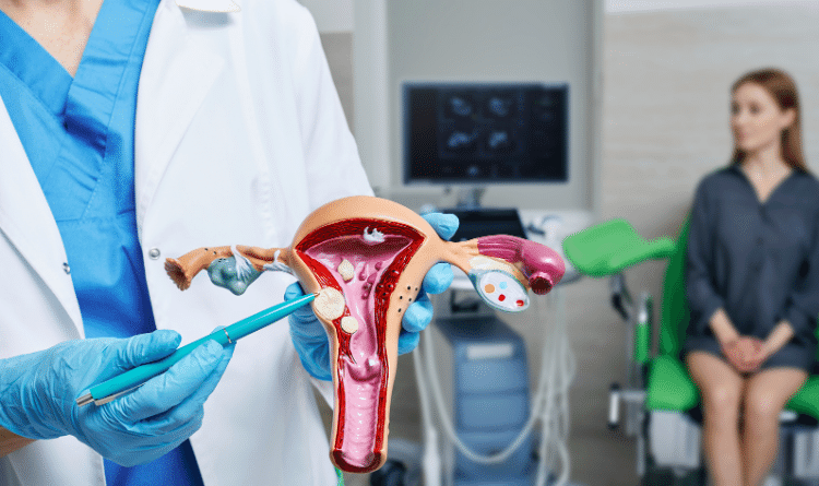 uterine fibroids intro image