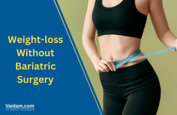 فقدان الوزن دون جراحة لعلاج البدانة