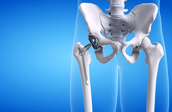 Keep your bones healthy with India’s leading orthopaedic surgeon Dr Avtar Singh