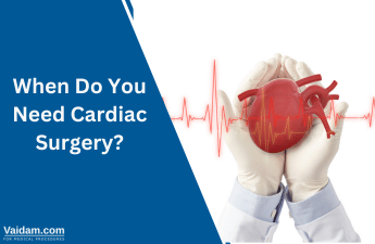 When Do You Need Cardiac Surgery?
